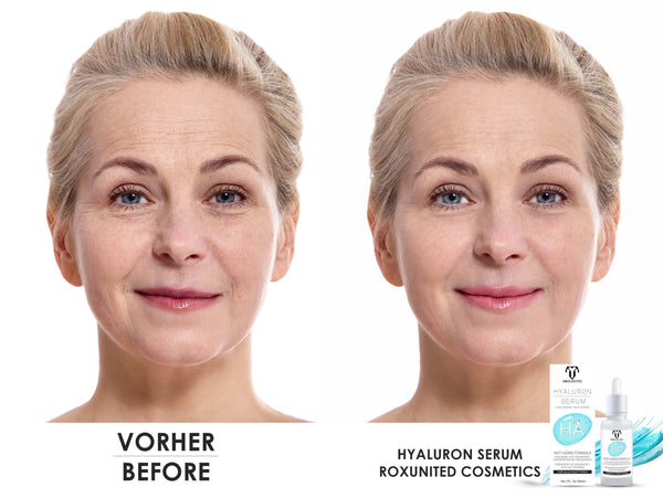 ROXUNITED Hyaluron Serum (30ml)